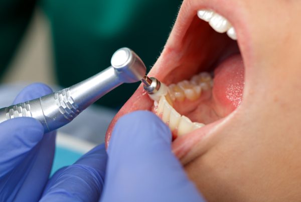 limpieza dental