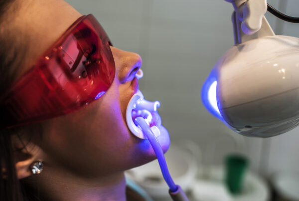 blanqueamiento dental profesional
