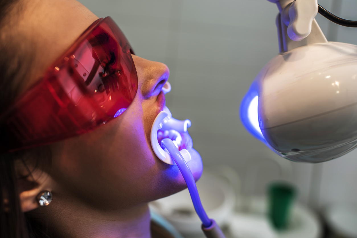 blanqueamiento dental profesional