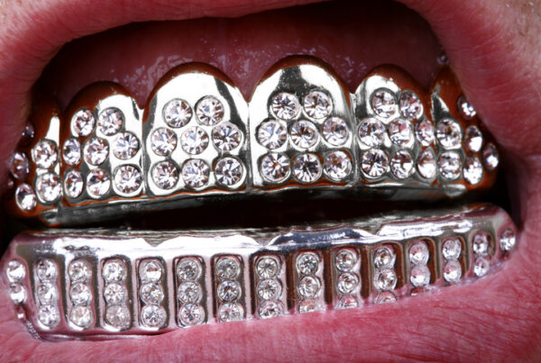 riesgos de los piercings orales