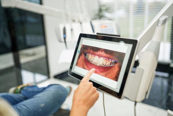 cuidar tus implantes dentales