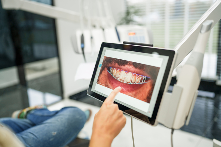 cuidar tus implantes dentales