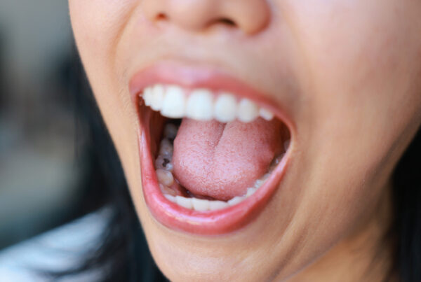 microbiota oral