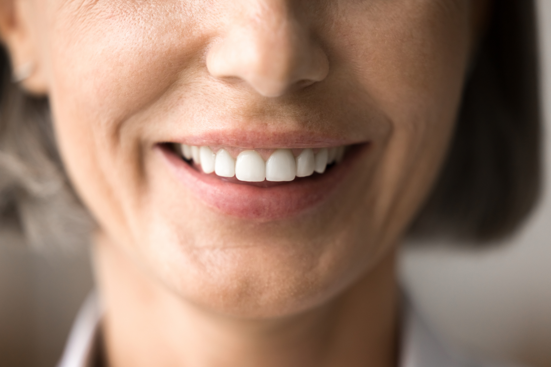 implantes dentales