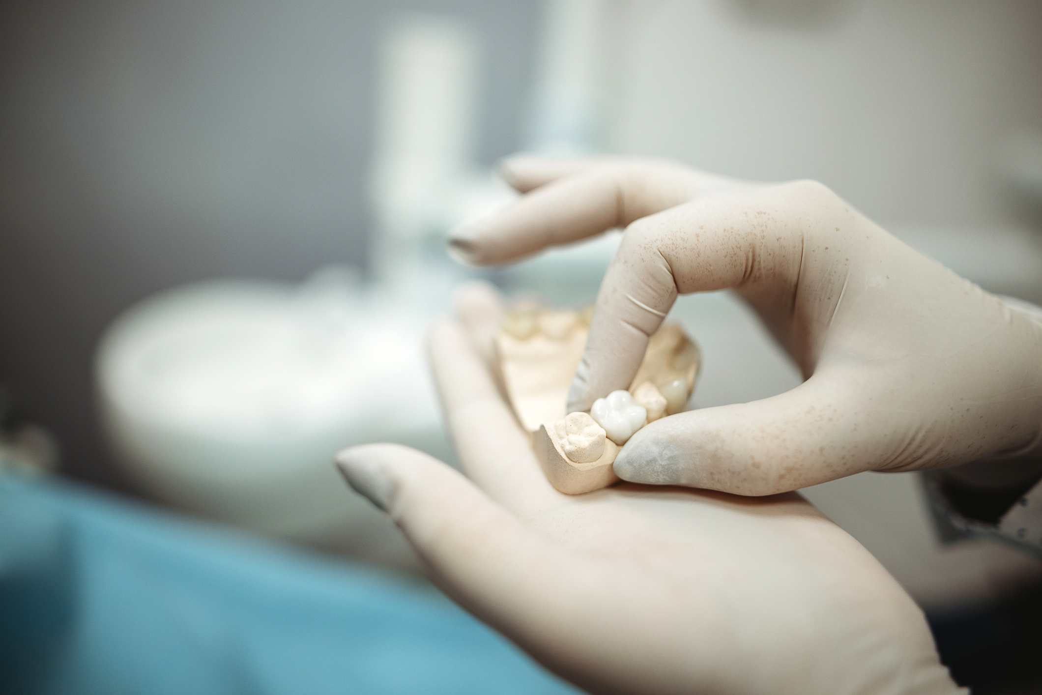corona dental